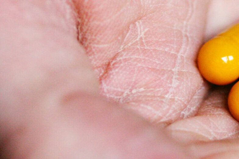 los-6-mejores-suplementos-para-prediabetes-y-diabetes