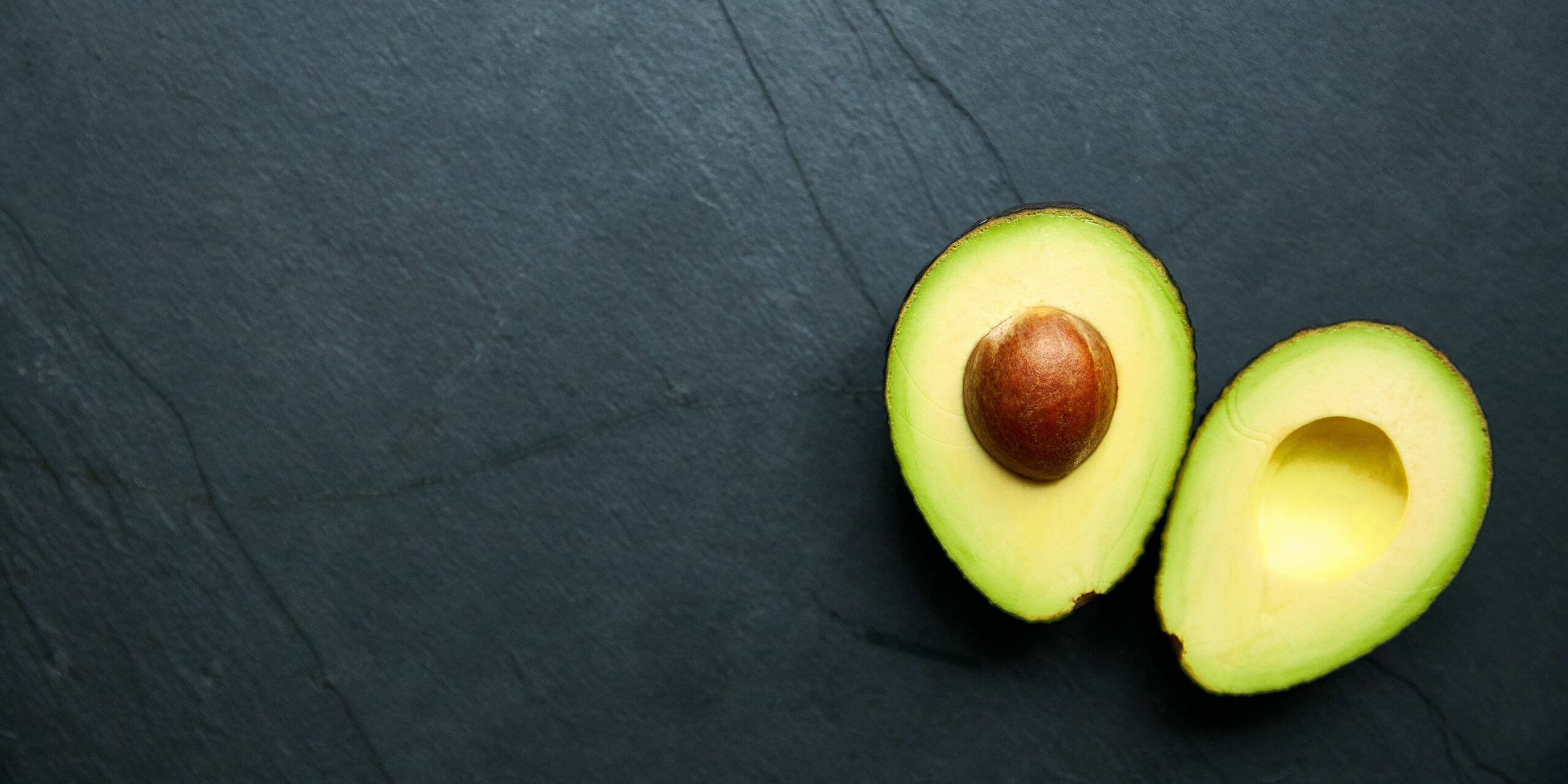 Nutrition Essentials Mental Health Avocado Scaled